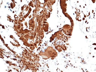 Anti-p44 MAPK (Erk1), Rabbit Monoclonal (RM470)