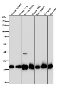 Anti-SDHB / Succinate dehydrogenase subunit B, clone 32S25