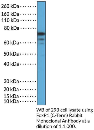 Anti-FOXP1 (C-Term) Rabbit Monoclonal Antibody (RM402)