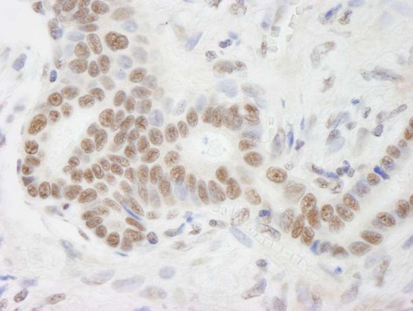 Anti-DHX9 (IHC)