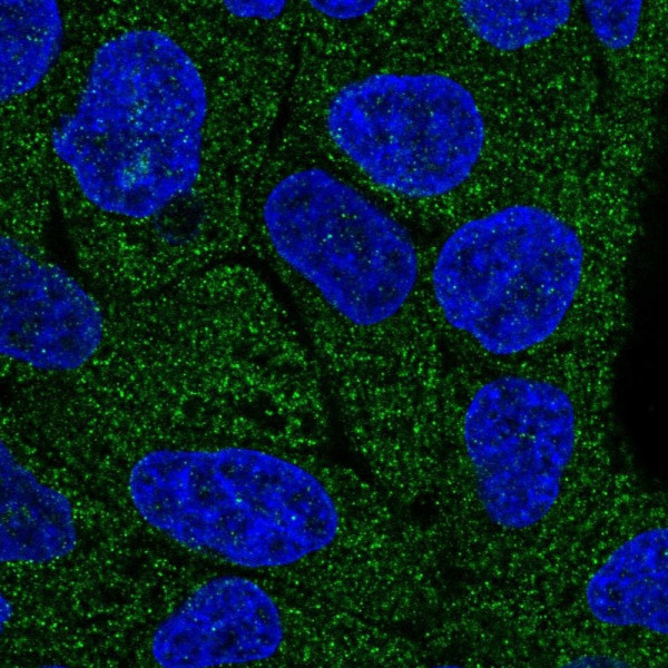 Anti-LRRC1