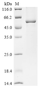 Acyloxyacyl hydrolase (AOAH), human, recombinant