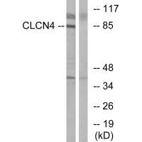 Anti-CLCN4