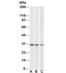 Anti-CAPZB (beta 2)