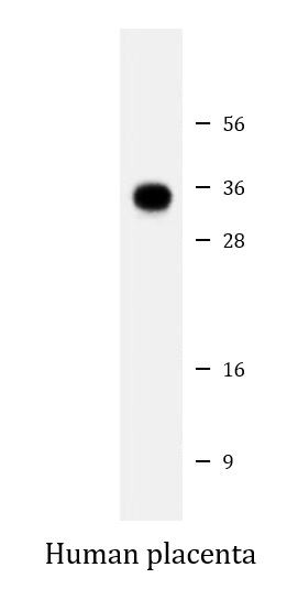 Anti-FOLR2, clone 1905CT501.41.76