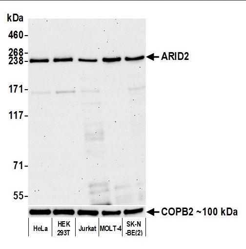 Anti-ARID2 Recombinant Monoclonal