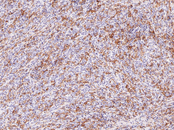 Anti-Hairy Cell Leukemia Monoclonal Antibody (Clone:IHC687)