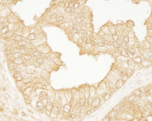 Anti-PDZ-RhoGEF (IHC)