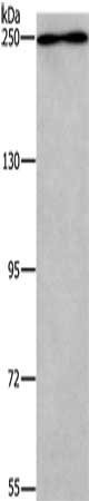 Anti-WNK3