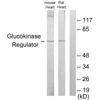 Anti-GCKR