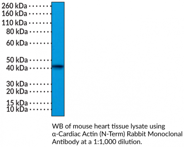 Anti-alpha-Cardiac Actin (N-Term) Rabbit Monoclonal Antibody (Clone RM257)