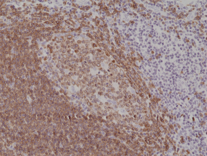 Anti-CD79a (C-term) (human), Rabbit Monoclonal (RM297)
