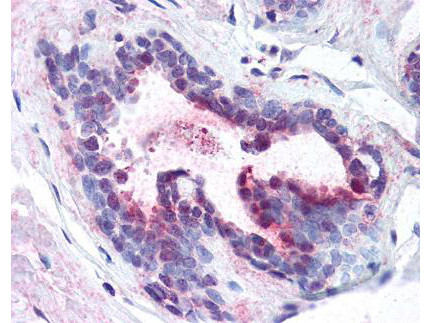 Anti-phospho-Pdcd4 (Ser457)