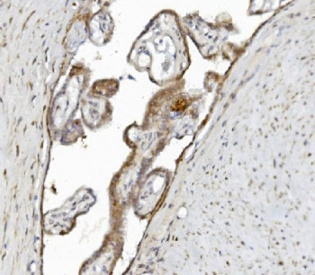 Anti-Argonaute 3 / AGO3