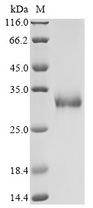 Erythropoietin receptor (EPOR), partial, human, recombinant