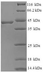 BEN domain-containing protein 3 (BEND3), partial, human, recombinant