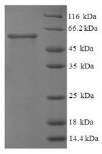 N-acetyl-D-glucosamine kinase (NAGK), human, recombinant
