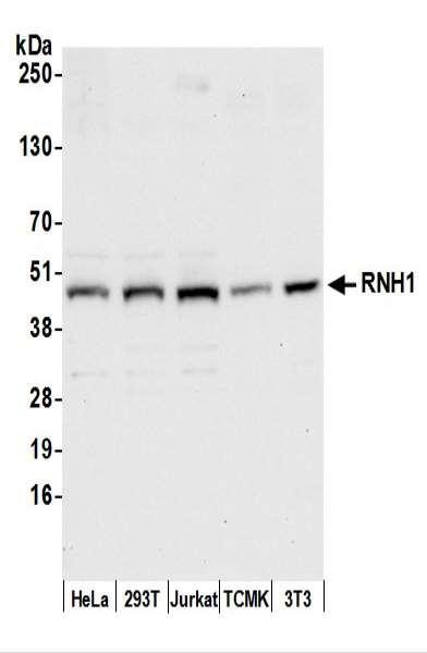 Anti-RNH1