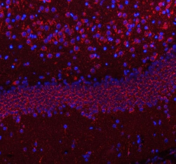 Anti-HCRT / Hypocretin neuropeptide precursor