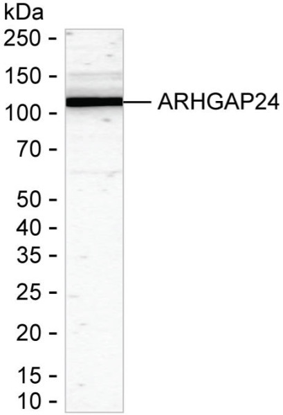 Anti-ARHGAP24