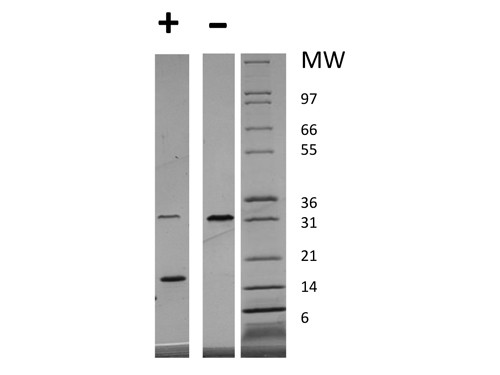 Platelet Derived Growth Factor-AA