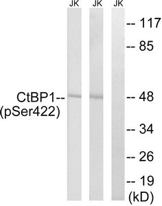Anti-Phospho-CTBP1 (Ser422)