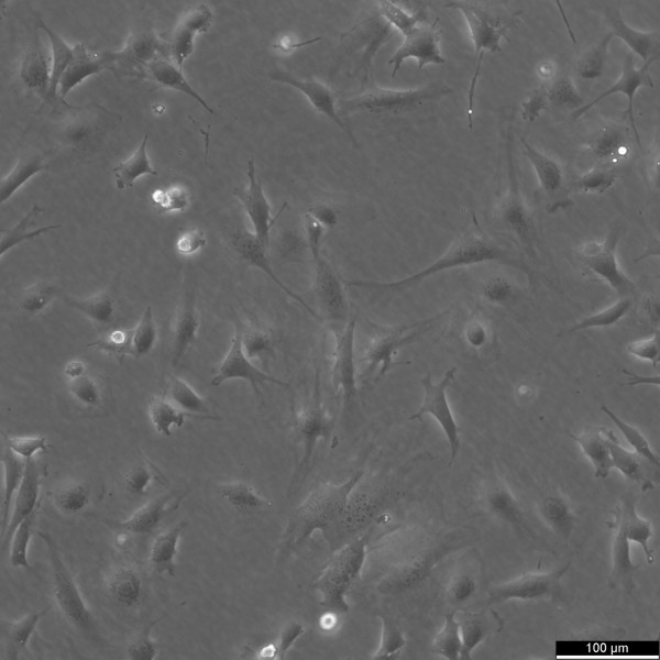 SVEC4-10 Cells