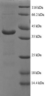 ATP synthase subunit delta, mitochondrial (ATP5F1D), partial, recombinant human