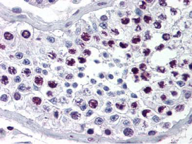 Anti-Cyclin A