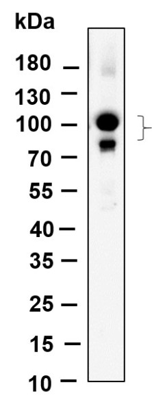 Anti-Recombinant CUL4A/B, clone 9D6