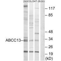 Anti-ABCC13