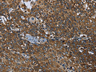 Anti-PRDM2
