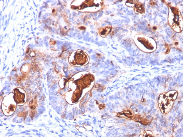 Anti-Carcinoembryonic Antigen (CEA) / CD66, clone COL-1 + CEA31 + C66/261