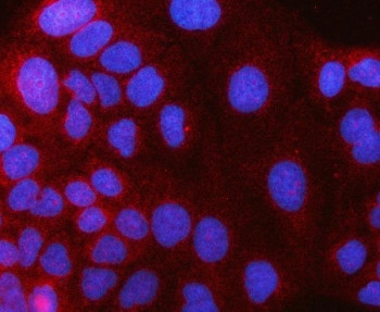 Anti-HAAO / 3-hydroxyanthranilate 3, 4-dioxygenase / 3HAO