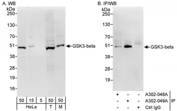 Anti-GSK3-beta