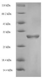 Coagulation factor V (F5), partial, human, recombinant