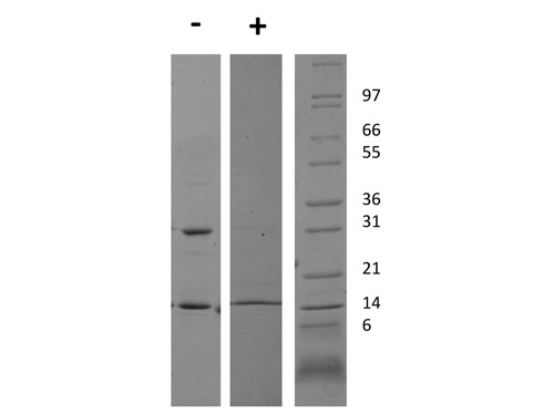 Interferon gamma