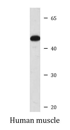 Anti-AKAP5