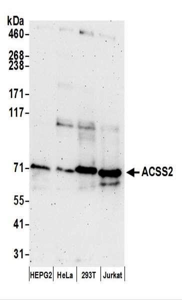 Anti-ACSS2/ACS