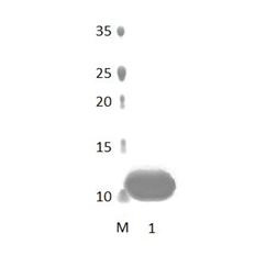DLG2_3 PDZ Domain