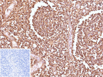 Anti-HLA-E / HLA class I histocompatibility antigen E, clone HLAE/9467
