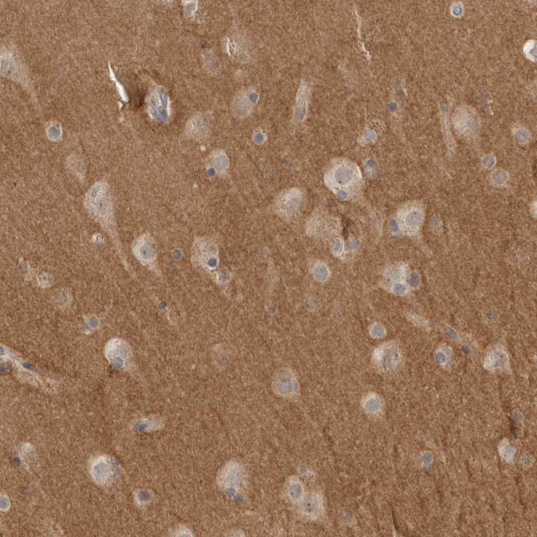 Anti-NRCAM