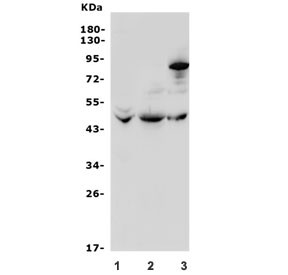 Anti-ADRB3 / Beta-3 Adrenergic Receptor