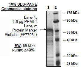 PRMT1 (expressed E. coli), active human recombinant protein