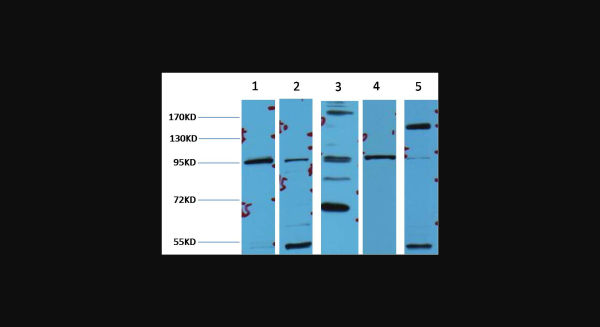 Anti-beta-Catenin, monoclonal