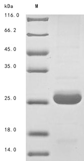 Angiopoietin-like protein 8 (Angptl8), mouse, recombinant