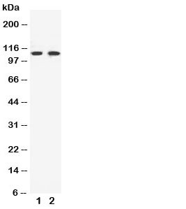 Anti-EphB3 Ephrin Receptor B3