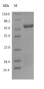 Band 3 anion transport protein (SLC4A1), partial, human, recombinant