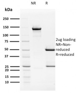 Anti-HPV16 E2, clone TVG 261