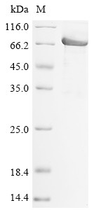 Desmoglein-2 (DSG2), partial, human, recombinant